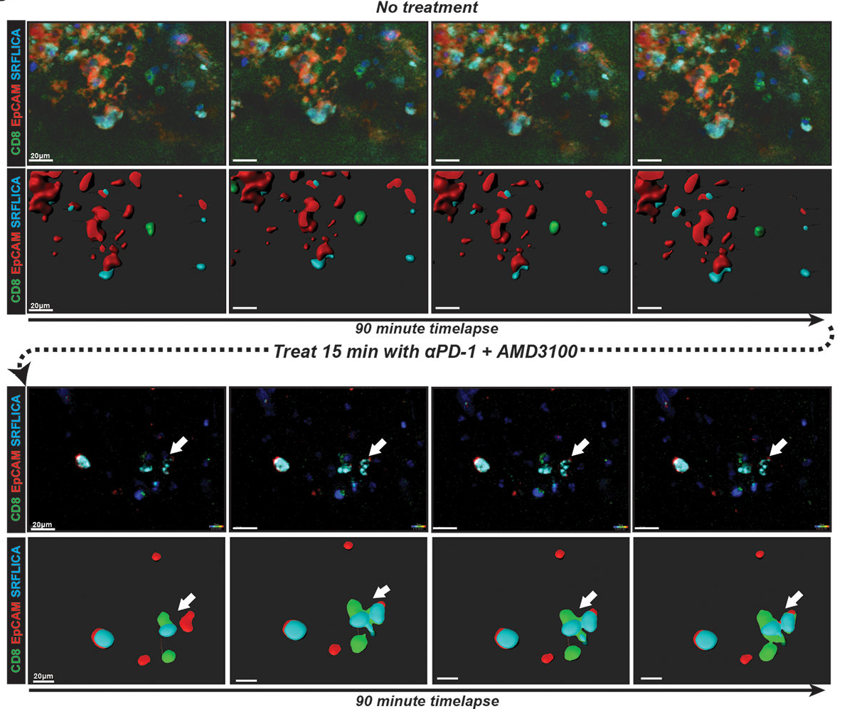 CXCR4 PD1 Data
